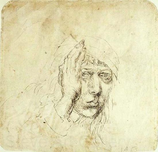 Albrecht Durer Self-Portrait with a Bandage